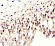 IHC analysis of FFPE human bladder section using SUMO2/3 antibody; Ab was diluted at 1:100.