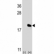 Western blot analysis of IL-17 antibody and 293 cell lysate (2 ug/lane) either nontransfected (Lane 1) or transiently transfected (2) with the IL17A gene. Expected molecular weight: 15-20 kDa (monomer), 30-40 kDa (homodimer), depending on glycosylation level.