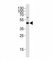 C9orf72 antibody western blot analysis in WiDr cell lysate