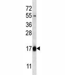 HBQ1 antibody western blot analysis in 293 lysate.~