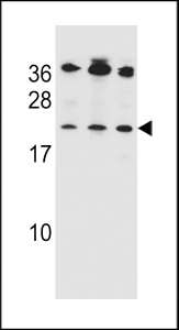 Bak antibody western blot analysis in 1) Jurkat, 2) MDA-MB453 and 3) 293 lysate