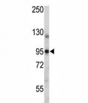 Progesterone Receptor antibody western blot analysis in breast cancer cell line T47D lysate. Expected molecular weight: 82-94 kDa (PR-A) and 99-120 kDa (PR-B).