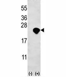 Western blot analysis of Bid antibody and 293 cell lysate (2 ug/lane) either nontransfected (Lane 1) or transiently transfected (2) with the Bid gene.