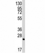 Western blot analysis of Bid antibody and mouse lung tissue lysate. Predicted molecular weight ~22 kDa.