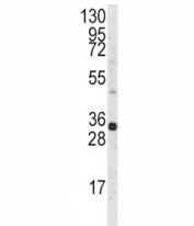 Western blot analysis of MCL1 antibody and Ramos lysate. Predicted molecular weight: 37/29 kDa (isoforms 1/2).