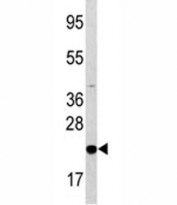 Western blot analysis of Bad antibody and HL-60 lysate. Predicted molecular weight: 19-23 kDa.