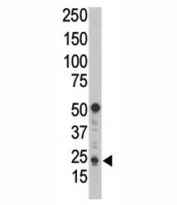 Western blot analysis of Puma antibody and HL-60 cell lysate. Predicted molecular weight: 21kDa.