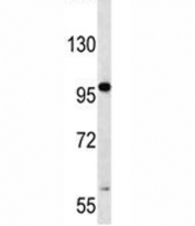 RNF43 antibody western blot analysis in human CCRF-CEM lysate. Predicted molecular weight: 72-95 kDa (isoforms 1-4).