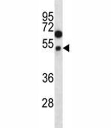 FOXA2 antibody western blot analysis in HL-60 lysate. Predicted molecular weight: 50 kDa.