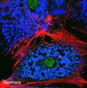 Freshly isolated mouse hepatocytes were cultured under normoxic conditions for 6 hr. and stained with BNIP3 antibody; Red: F-actin, Blue: ATP-synthase, Green: BNIP3. (Courtesy of Ruben Zamora, University of Pittsburgh.)