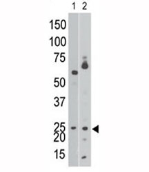 The BNIP3 antibody western blot analysis of Ramos cell lysate (lane 1) and in mouse brain tissue lysate (2).
