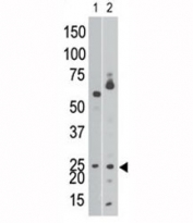 The BNIP3 antibody western blot analysis of Ramos cell lysate (lane 1) and in mouse brain tissue lysate (2). Expected molecular weight: 19-21 kDa.