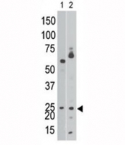 The BNIP3 antibody western blot analysis of Ramos cell lysate (lane 1) and in mouse brain tissue lysate (2). Expected molecular weight: 19-21 kDa.