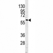 Western blot analysis of Caspase-10 antibody and HepG2 lysate.