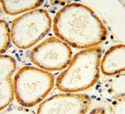 IHC analysis of FFPE human lung with Caspase-2 antibody