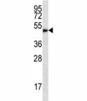 HDAC3 antibody western blot analysis in HL-60 lysate. Predicted molecular weight ~49kDa.