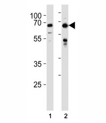 FOXO3 antibody western blot analysis in HeLa,MCF-7 lysate. Predicted/observed molecular weight ~70 kDa.