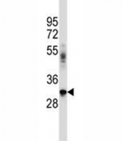 BNIP2 antibody western blot analysis in A549 lysate