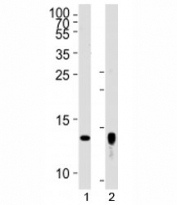 Western blot analysis of lysate from human placenta tissue lysate, SK-BR-3 cell line (left to right) using Trx2 antibody diluted at 1:1000 for each lane.