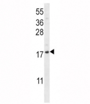 CXCL12 antibody western blot analysis in NCI-H292 lysate. Predicted molecular weight: 9-12 kDa.