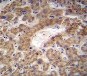 CXCL12 antibody immunohistochemistry analysis in formalin fixed and paraffin embedded human liver tissue.~