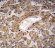 CXCL12 antibody immunohistochemistry analysis in formalin fixed and paraffin embedded human liver tissue.