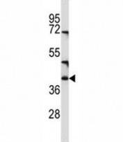 CD1c antibody western blot analysis in NCI-H460 lysate. Predicted molecular weight ~38 kDa (unmodified), ~43 kDa (glycosylated).