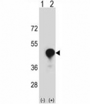 Western blot analysis of CD1c antibody and 293 cell lysate (2 ug/lane) either nontransfected (Lane 1) or transiently transfected (2) with the CD1C gene. Predicted molecular weight ~38 kDa (unmodified), ~43 kDa (glycosylated).