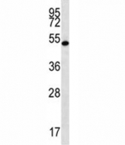 RNF8 antibody western blot analysis in mouse spleen tissue lysate. Predicted molecular weight: 55/51 kDa (isoforms 1/3), but may be observed at larger sizes due to ubiquitination.