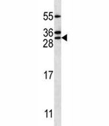 RAB5C antibody western blot analysis in Jurkat lysate.