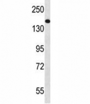 NPC1 antibody western blot analysis in NCI-H460 lysate. Predicted molecular weight ~142/170~190 kDa (unmodified/glycosylated).