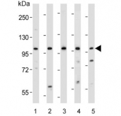 Western blot testing of human 1) Jurkat, 2) U266B1, 3) RPMI 8226, 4) HT-29 and 5) SW480 lysate with NLRP9 antibody. Predicted molecular weight ~99 kDa.