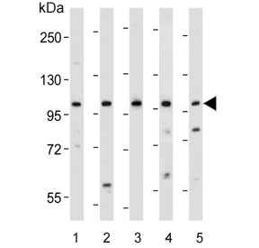Western blot testing of human 1) Jurkat, 2) U266B1, 3) RPMI 8226, 4) HT-29 and 5) SW480 lysate with NLRP9 antibody. Predicted molecular weight ~99 kDa.