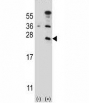 Western blot analysis of CD3e antibody and 293 cell lysate (2 ug/lane) either nontransfected (Lane 1) or transiently transfected (2) with the CD3E gene.