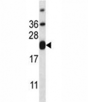 CD3e antibody western blot analysis in HL-60 lysate. Expected/observed molecular weight ~23kDa.