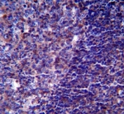 CD5 antibody immunohistochemistry analysis in formalin fixed and paraffin embedded human tonsil tissue.