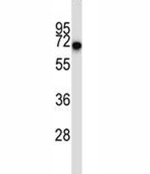 CD5 antibody western blot analysis in ZR-75-1 lysate. Observed molecular weight 55~67 kDa depending on glycosylation level.~