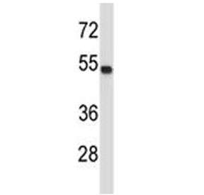 TUBA4A antibody western blot analysis in MDA-MB435 lysate.~