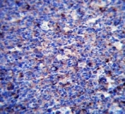 MMP3 antibody immunohistochemistry analysis in formalin fixed and paraffin embedded human tonsil tissue.