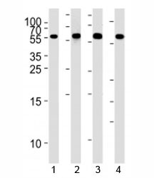 Western blot analysis of lysate from 1) HepG2, 2) NCI-H460,3) Raji, and 4) Ramos cell line using MMP3 antibody at 1:1000.