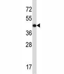 ACTG2 antibody western blot analysis in CEM lysate