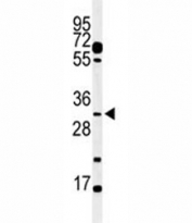 Western blot analysis of PHO3 antibody and mouse testis tissue lysate. Predicted molecular weight ~46 kDa, but commonly observed at 35-46 kDa.