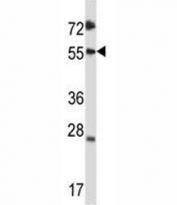 SMAD3 antibody western blot analysis in CEM lysate. Observed molecular weight: 48~55 kDa.