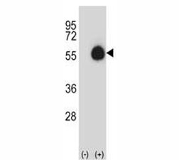 Western blot analysis of CD33 antibody and 293 cell lysate (2 ug/lane) either nontransfected (Lane 1) or transiently transfected (2) with the CD33 gene.~