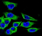Confocal immunofluorescent analysis of LDHA antibody with A375 cells followed by Alexa Fluor 488-conjugated goat anti-rabbit lgG (green). DAPI was used as a nuclear counterstain (blue).
