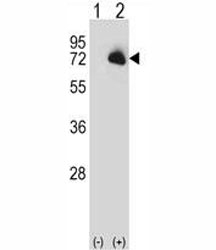 Western blot analysis of BTK antibody and 293 cell lysate (2 ug/lane) either nontransfected (Lane 1) or transiently transfected (2) with the BTK gene.