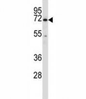 BTK antibody western blot analysis in HL-60 lysate