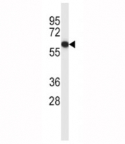 Estrogen Receptor antibody western blot analysis in MCF-7 lysate. Predicted molecular weight: 65-70 kDa.