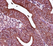 Estrogen Receptor antibody immunohistochemistry analysis in formalin fixed and paraffin embedded human uterus tissue.