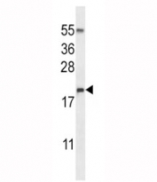 RNASE3 antibody western blot analysis in NCI-H460 lysate. Predicted molecular weight ~18 kDa.